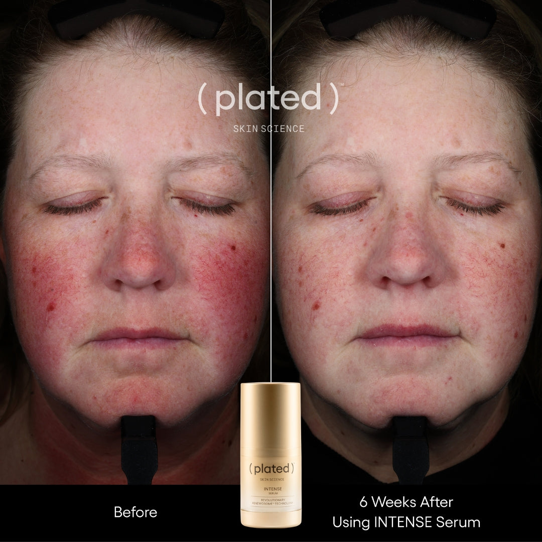 Plated Skin Science INTENSE Serum