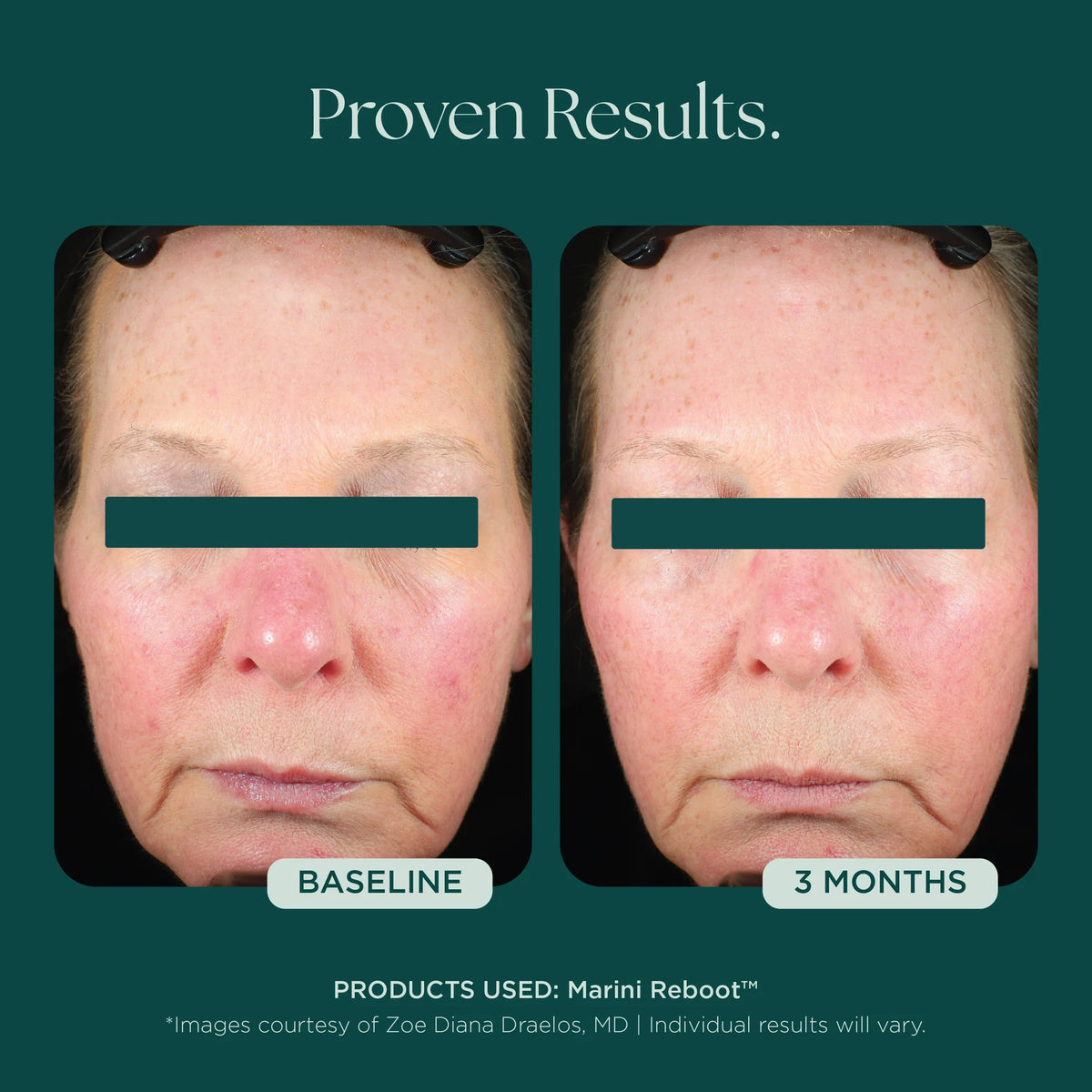 Marini SkinSolutions Reboot® PDRN Face Serum