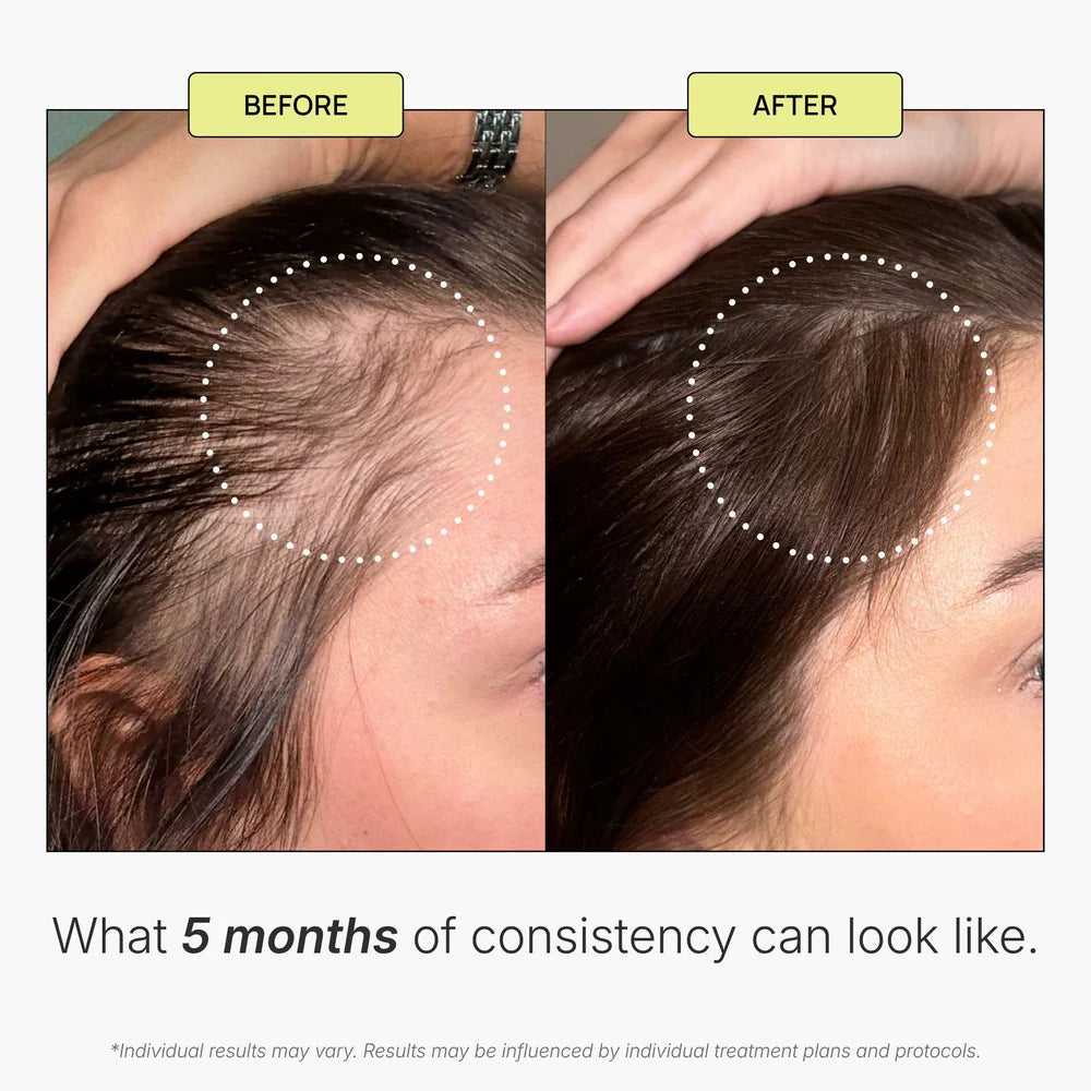 Scalp Stimulating Solution by KeraFactor