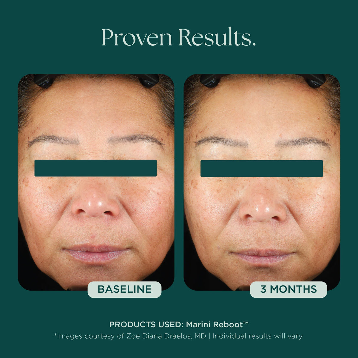 Marini SkinSolutions Reboot® PDRN Face Serum