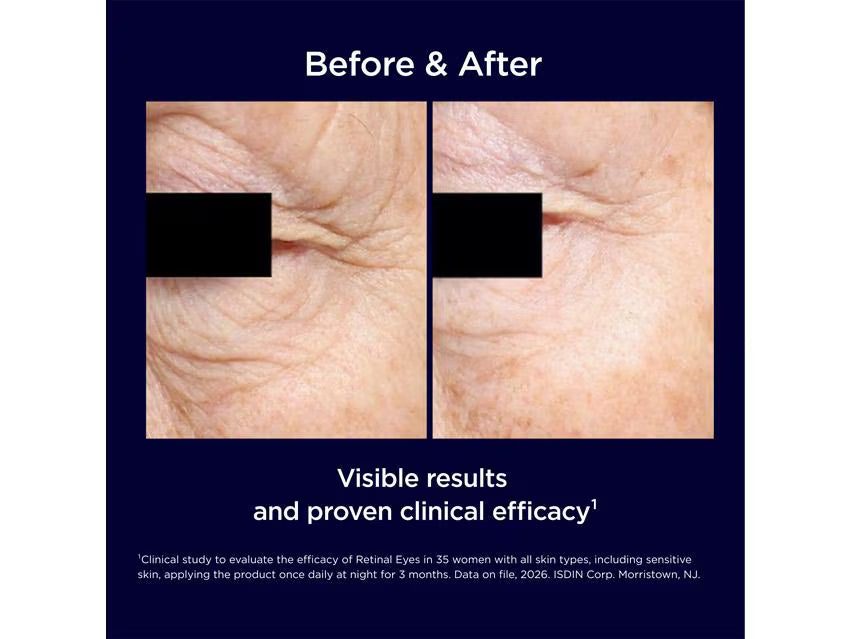 ISDIN Isdinceutics® Retinal Eye Serum